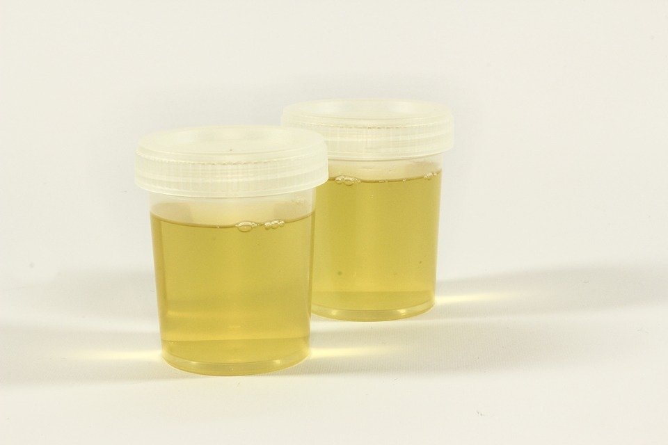 Liability Insurance for Urinalysis